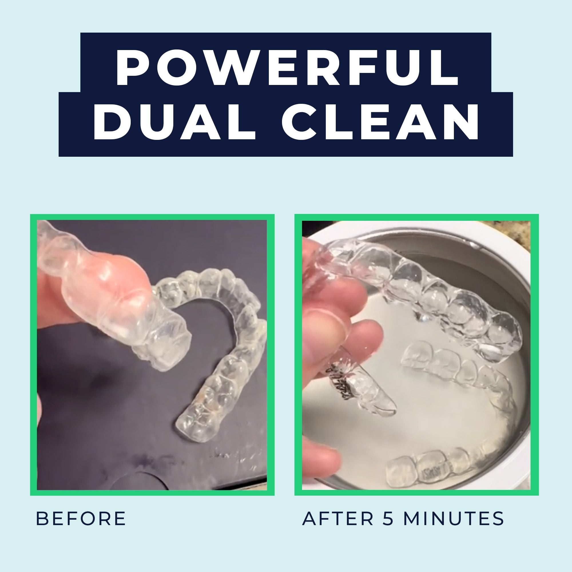 MyDepod™- Ultrasonic Retainer Cleaner with UV lights